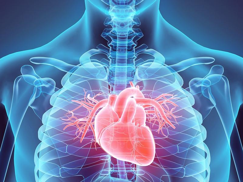 Critical Care Cardiology MCQ